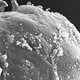 Bioengenharia - imagens ampliadas de tecido equivalente formado por clulas de cordo umbilical obtidas em microscpio de varredura